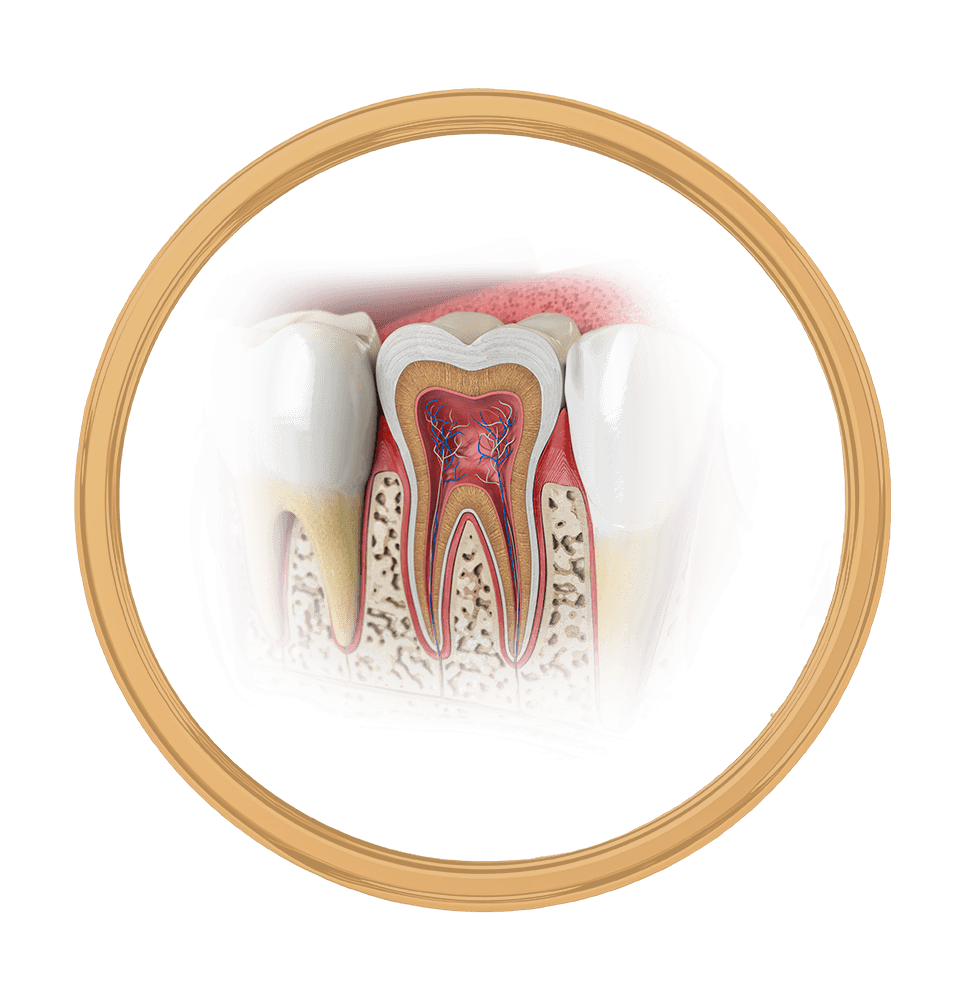 close up illustration of root canal